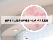 春天手背上起癣但不痒是什么病 手背上起藓