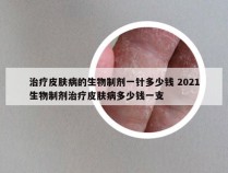 治疗皮肤病的生物制剂一针多少钱 2021生物制剂治疗皮肤病多少钱一支