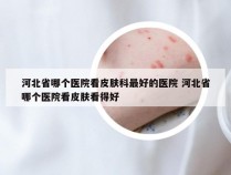 河北省哪个医院看皮肤科最好的医院 河北省哪个医院看皮肤看得好