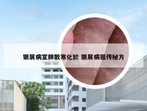 银屑病宣肺散寒化於 银屑病祖传秘方