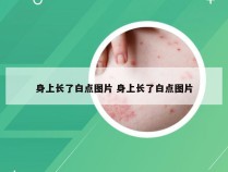 身上长了白点图片 身上长了白点图片