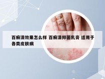 百癣清效果怎么样 百癣清抑菌乳膏 适用于各类皮肤病