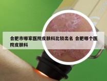 合肥市哪家医院皮肤科比较出名 合肥哪个医院皮肤科