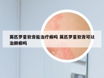 莫匹罗星软膏能治疗癣吗 莫匹罗星软膏可以治脚癣吗