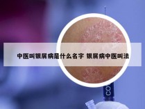 中医叫银屑病是什么名字 银屑病中医叫法