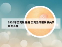 2820年类克银屑病 类克治疗银屑病关节炎怎么样