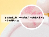 小孩胳膊上长了一个癣图片 小孩胳膊上长了一个癣图片大全