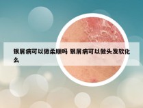 银屑病可以做柔顺吗 银屑病可以做头发软化么