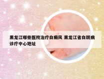 黑龙江哪些医院治疗白癜风 黑龙江省白斑病诊疗中心地址