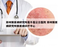 郑州银屑病研究所是不是公立医院 郑州银屑病研究所银屑病诊疗中心