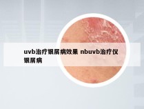 uvb治疗银屑病效果 nbuvb治疗仪 银屑病