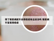 得了银屑病就不会得癌症有这说法吗 银屑病不容易得癌症