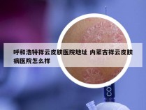 呼和浩特祥云皮肤医院地址 内蒙古祥云皮肤病医院怎么样