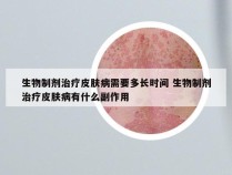 生物制剂治疗皮肤病需要多长时间 生物制剂治疗皮肤病有什么副作用