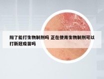 阳了能打生物制剂吗 正在使用生物制剂可以打新冠疫苗吗