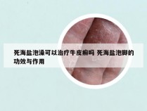 死海盐泡澡可以治疗牛皮癣吗 死海盐泡脚的功效与作用