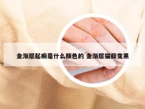 金渐层起癣是什么颜色的 金渐层猫藓变黑