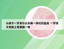 小孩子一岁多什么长癣一样红红起皮 一岁孩子皮肤上有像癣一样