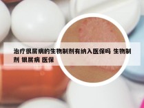 治疗很屑病的生物制剂有纳入医保吗 生物制剂 银屑病 医保