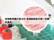 生物制剂要打多少针 生物制剂多少钱一针要打多久