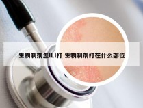 生物制剂怎ILl打 生物制剂打在什么部位