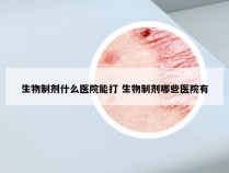 生物制剂什么医院能打 生物制剂哪些医院有