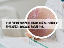 内眼角的外周感觉似有似无的白点 内眼角的外周感觉似有似无的白点是什么