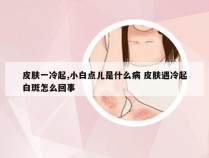 皮肤一冷起,小白点儿是什么病 皮肤遇冷起白斑怎么回事