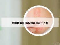 祛癣拨毒膏 癣痒拔毒膏治什么病