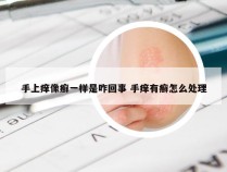 手上痒像癣一样是咋回事 手痒有癣怎么处理