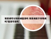 银屑病可以特种病医保吗 银屑病属于特殊病吗?医保可报吗