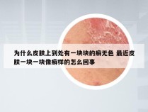 为什么皮肤上到处有一块块的癣无色 最近皮肤一块一块像癣样的怎么回事