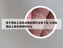 孩子发丝上有白点类似鳞片还有个尖 小孩头发丝上有白管状叫什么