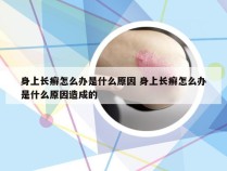 身上长癣怎么办是什么原因 身上长癣怎么办是什么原因造成的