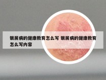 银屑病的健康教育怎么写 银屑病的健康教育怎么写内容