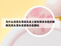 为什么洗完头发后头皮上就有很多白色的癣 刚洗完头发头皮就有白色颗粒