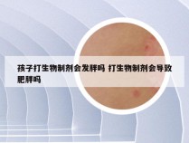 孩子打生物制剂会发胖吗 打生物制剂会导致肥胖吗