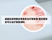 庸医给我用糖皮质激素治疗银屑病 糖皮质激素可以治疗银屑病吗