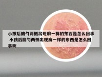 小孩后脑勺两侧出现癣一样的东西是怎么回事 小孩后脑勺两侧出现癣一样的东西是怎么回事啊