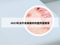 2023年治牛皮癣最好的医院是哪家