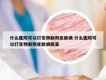 什么医院可以打生物制剂皮肤病 什么医院可以打生物制剂皮肤病疫苗