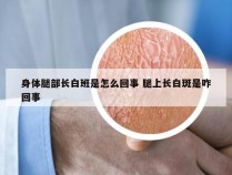 身体腿部长白班是怎么回事 腿上长白斑是咋回事