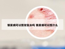 银屑病可以擦双氧水吗 银屑病可以擦什么