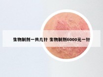 生物制剂一共几针 生物制剂6000元一针