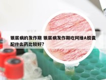 银屑病的发作期 银屑病发作期吃阿维A胶囊配什么药比较好?