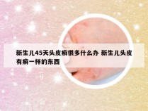 新生儿45天头皮癣很多什么办 新生儿头皮有癣一样的东西