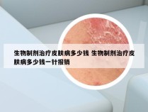 生物制剂治疗皮肤病多少钱 生物制剂治疗皮肤病多少钱一针报销