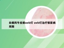 白癜风牛皮癣uvb灯 uvb灯治疗银屑病周期