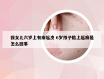 我女儿六岁上有癣起皮 6岁孩子脸上起癣是怎么回事