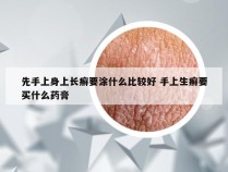 先手上身上长癣要涂什么比较好 手上生癣要买什么药膏